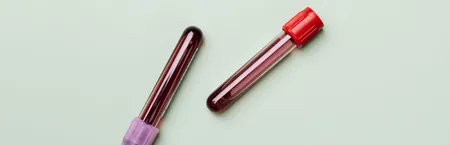 Two blood sample tubes, part of a clinic's laboratory running costs